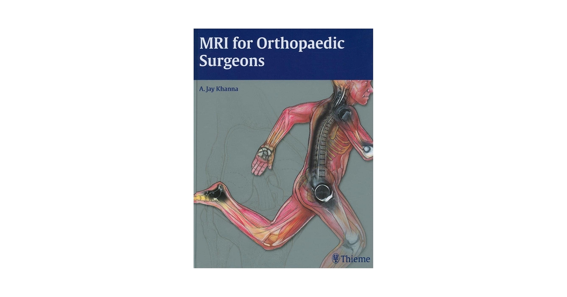 健康・医学 MRI ARTHROSCOPY and SURGICAL ANATOMY MRI-Arthroscopy Correlations: A Case-Based Atlas of the Knee